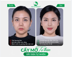 Gương mặt hóp, thiếu sức sống?