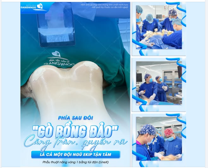PHÍA SAU ĐÔI GÒ BỒNG ĐẢO CĂNG TRÒN, QUYẾN RŨ - LÀ CẢ MỘT ĐỘI NGŨ EKIP TẬN TÂM