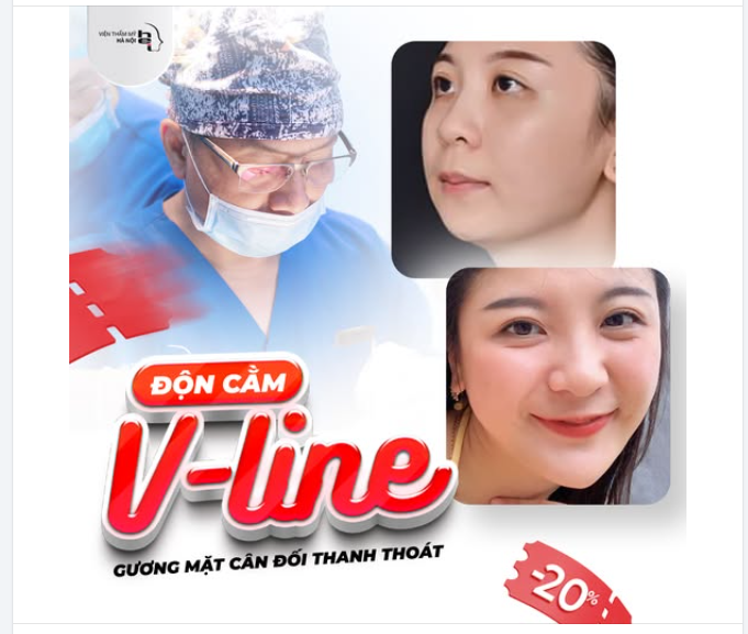 ĐỘN CẰM VLINE - MẶT ĐẸP HOÀN MỸ