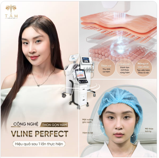 Không cần thay đổi quá nhiều, chỉ cần gọn lại phần hàm một chút là tổng thể khuôn mặt đã thanh thoát hơn rõ rệt