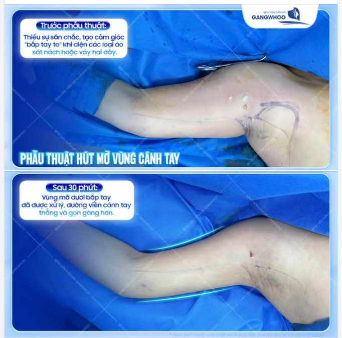 TỰ TIN DIỆN VÁY HAI DÂY VỚI BỜ VAI THANH TÚ