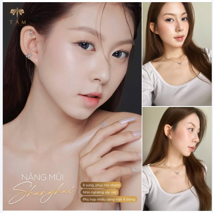 Nâng mũi Shanghai là sự lựa chọn cho khách hàng yêu thích vẻ đẹp tự nhiên, tôn lên đường nét sẵn có thay vì thay đổi hoàn toàn.