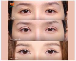 GIÁ TRỊ KHÔNG NẰM Ở MỨC GIÁ BAN ĐẦU - MÀ NẰM Ở VIỆC 5 NĂM SAU, BẠN VẪN THẤY MÌNH ĐẸP