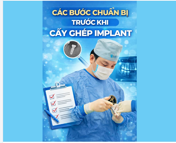 Các bước chuẩn bị trước khi cấy ghép Implant
