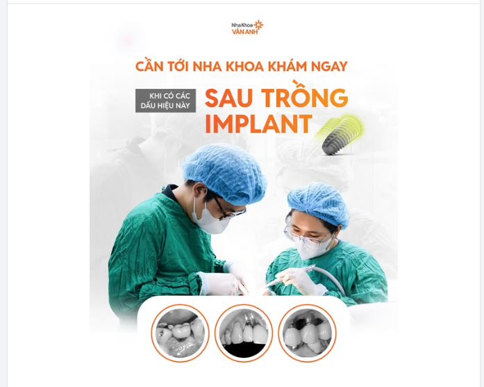 ĐỪNG "TỰ NHỦ" LÀ KHÔNG SAO: 5 DẤU HIỆU CẦN TỚI NHA KHOA SAU CẤY VÀ PHỤC HÌNH RĂNG IMPLANT