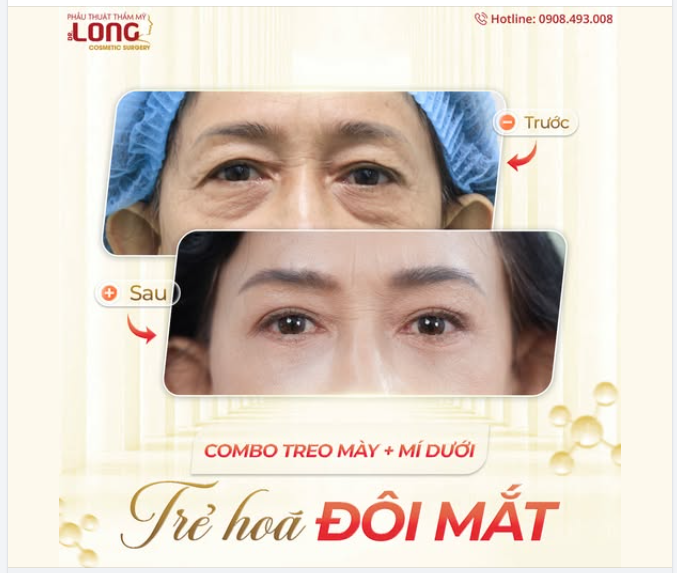 Bí quyết trẻ đẹp Cho khách hàng U70