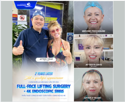 2 NĂM NHÌN LẠI VẪN TRẺ HÓA