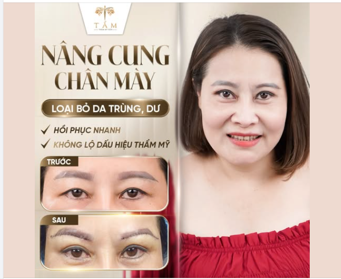 CÓ MÍ NHƯNG DA TRÙNG, DA DƯ NHIỀU PHẢI LÀM THẾ NÀO?