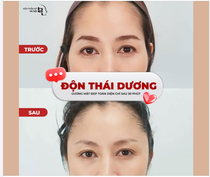ĐỘN THÁI DƯƠNG - GƯƠNG MẶT THANH TÚ