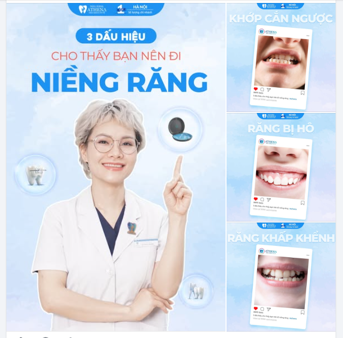 3 DẤU HIỆU CHO THẤY BẠN NÊN ĐI NIỀNG RĂNG