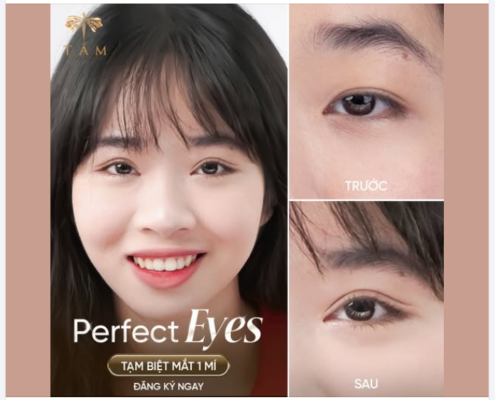 Cắt mí TỰ NHIÊN - AN TOÀN