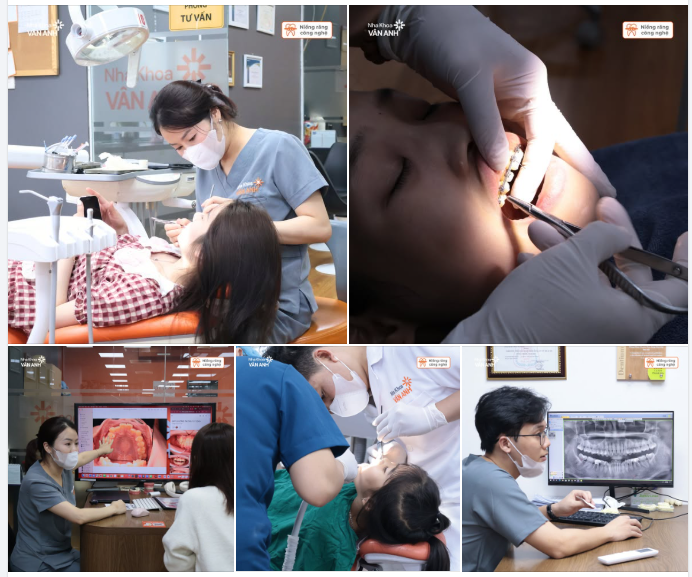 Niềng răng không chỉ là câu chuyện của mắc cài. Mà là câu chuyện của cả sức khỏe răng miệng.