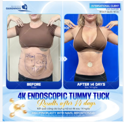 HÀNH TRÌNH TÌM LẠI VÒNG EO "SĂN CHẮC" CỦA KHÁCH ÚC