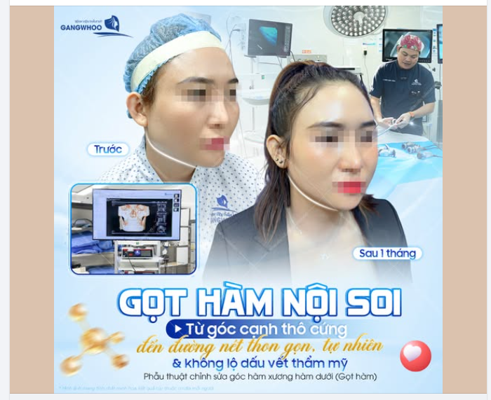 TỪ GÓC CẠNH THÔ CỨNG ĐẾN ĐƯỜNG NÉT THON GỌN TỰ NHIÊN