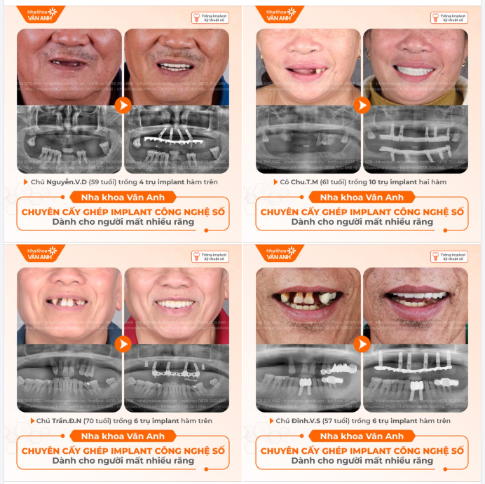 CÔ CHÚ MẤT NHIỀU RĂNG CÓ TỪNG RƠI VÀO VÒNG SUY NGHĨ NÀY?