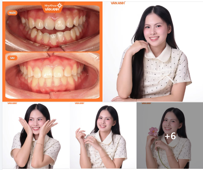 Lưu giữ phiên bản rạng rỡ của chính mình vì mỗi hành trình đều xứng đáng được ghi nhận