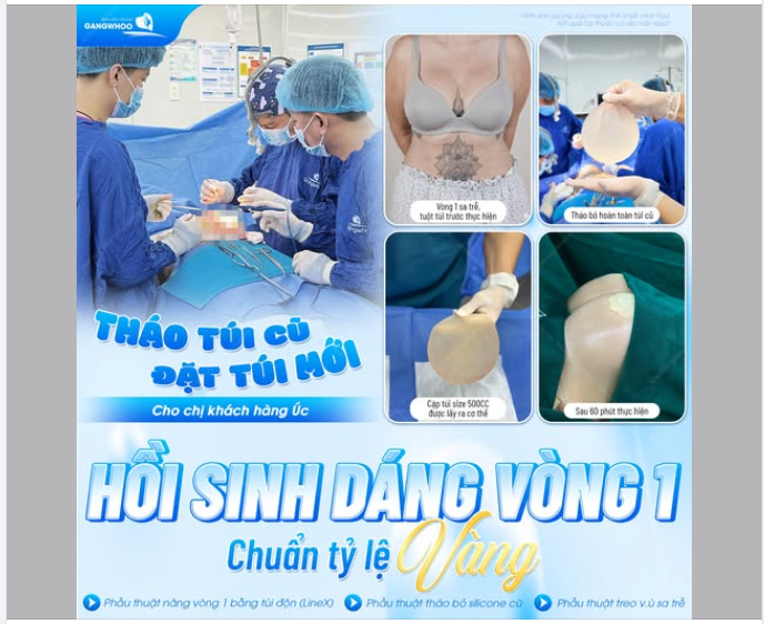 THÁO TÚI CŨ, ĐẶT TÚI MỚI CHO CHỊ KHÁCH HÀNG ÚC - HỒI SINH DÁNG VÒNG 1 CHUẨN TỶ LỆ VÀNG