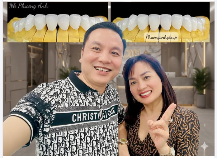 Các Vấn Đề Thường Gặp Sau Khi Trồng Răng Sứ Và Cách Khắc Phục