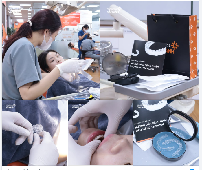 “Liệu có phương pháp niềng răng nào vừa hiệu quả, vừa thoải mái trong sinh hoạt hàng ngày?”