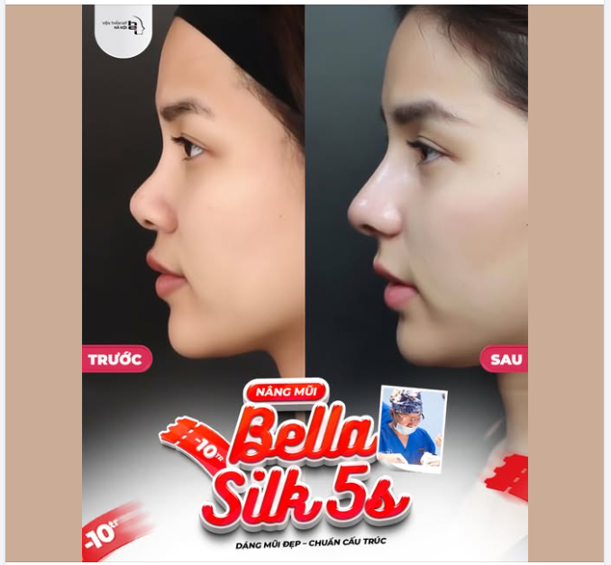 Đừng đợi đến lúc thanh xuân qua đi mới dám rực rỡ. Một chiếc mũi thanh tú là món quà tuyệt vời nhất bạn dành tặng cho chính bản thân mình