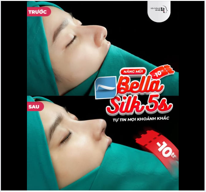 GÓC NGHIÊNG "HẾT NƯỚC CHẤM" – TỰ TIN CAM THƯỜNG VỚI BELLA SILK 5S