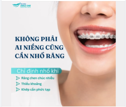 NIỀNG RĂNG LÀ BẮT BUỘC PHẢI NHỔ RĂNG?