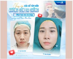 NÂNG CẤP CỬA SỔ TÂM HỒN - HỒI SINH NÉT RẠNG RỠ