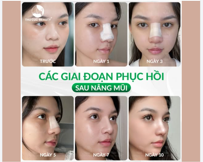 Hành trình thay đổi của khách hàng Minh Anh: