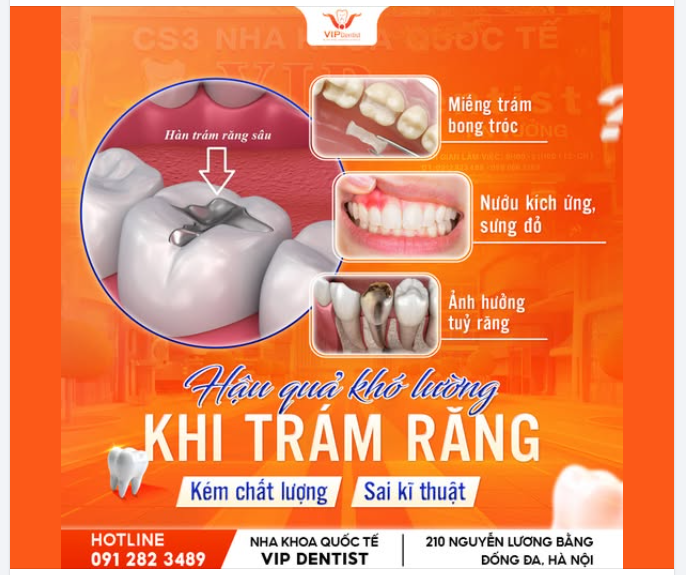 KHÔNG PHẢI MIẾNG TRÁM NÀO CŨNG GIỐNG NHAU?