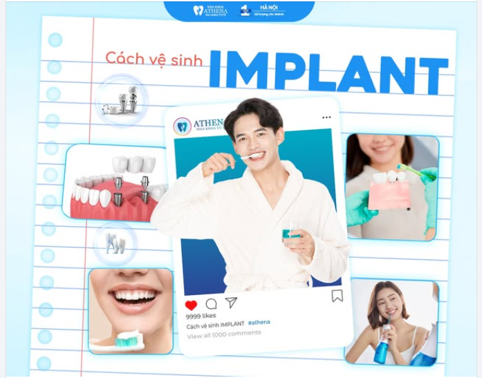 Cách vệ sinh răng Implant để bền lâu  Implant có thể dùng rất lâu, nhưng chỉ khi bạn chăm sóc đúng cách mỗi ngày
