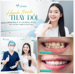 Niềng răng - để nụ cười không chỉ đẹp, mà còn khoẻ mạnh từ bên trong