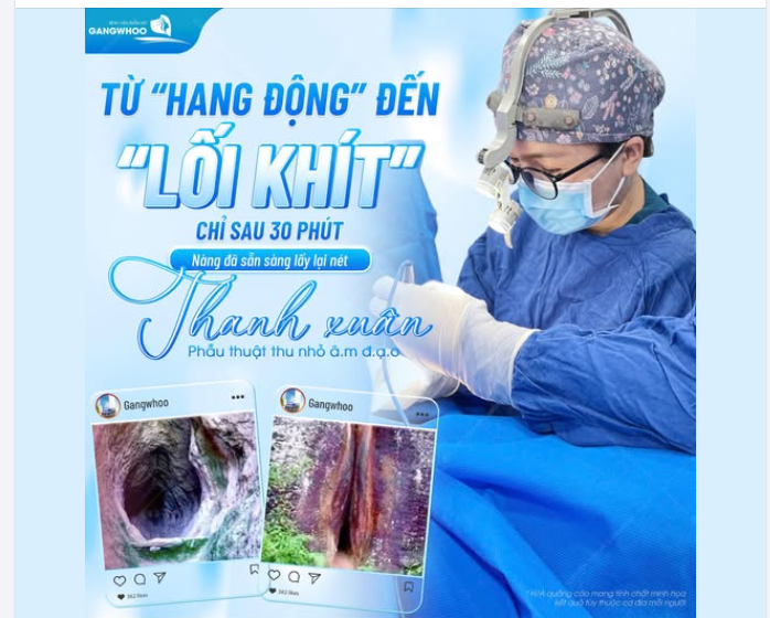 TỪ “RỘNG LỎNG” ĐẾN “KHÍT GỌN” CHỈ SAU 30 PHÚT