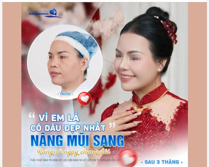 VÌ EM LÀ CÔ DÂU ĐẸP NHẤT