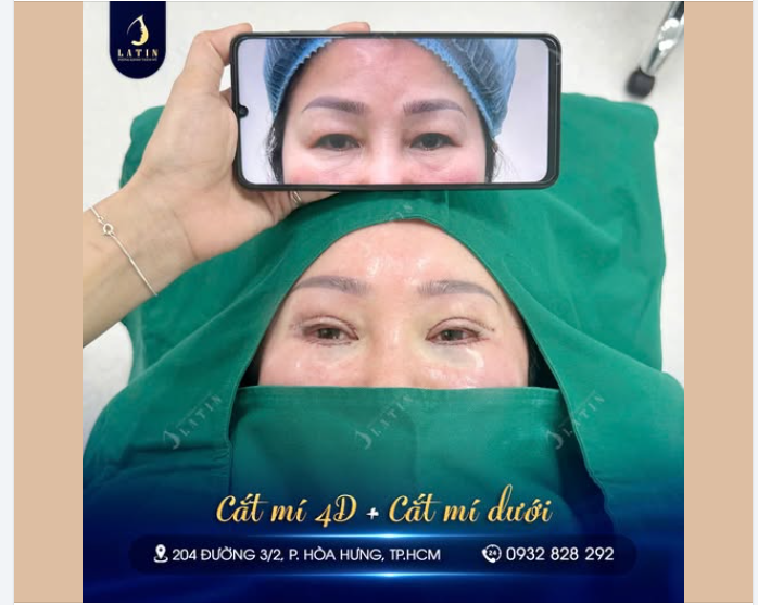 MẤT ĐI MÍ LÓT – ÁNH NHÌN RÕ NÉT HƠN HẲN