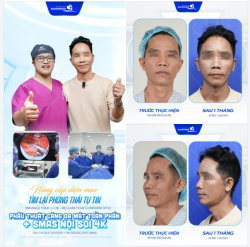 Dấu hiệu thời gian như nếp nhăn sâu, cơ mặt chảy xệ không chỉ lấy đi vẻ trẻ trung mà còn làm mờ đi sự tự tin vốn có. Đã đến lúc "tạm biệt" vẻ ngoài mệt mỏi để quay ngược kim đồng hồ tuổi tác!