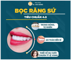 BỌC RĂNG SỨ – NỤ CƯỜI ĐẸP CHUẨN 4.0