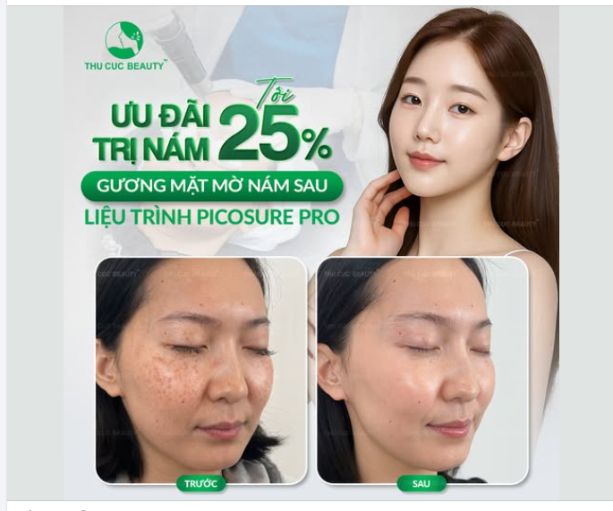 Tốn quá nhiều thời gian và tiền bạc cho các loại kem bôi nhưng đốm nám vẫn hoàn nám?