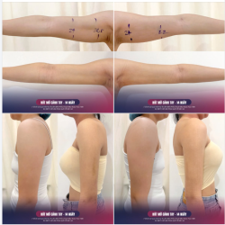 DỊCH VỤ ĐANG ĐƯỢC NHIỀU CHỊ EM SĂN ĐÓN…