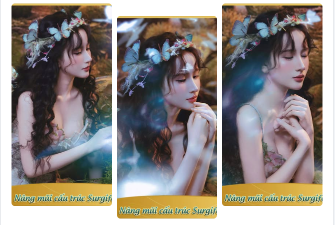 Mãn nhãn với vẻ đẹp “Như cô tiên bước ra từ cổ tích" sau nâng mũi của quý Cô