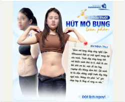 FEEDBACK TỪ KHÁCH HÀNG SAU GIẢM MỠ BỤNG