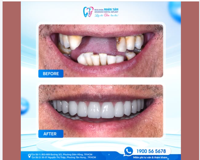 TRĂM LỜI QUẢNG CÁO KHÔNG BẰNG MỘT SỰ HÀI LÒNG THẬT TỪ KHÁCH HÀNG