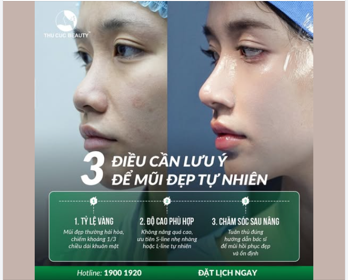 Mũi thấp, tẹt khiến gương mặt thiếu điểm nhấn? Đừng vội nâng mũi khi chưa biết 3 điều quan trọng này!