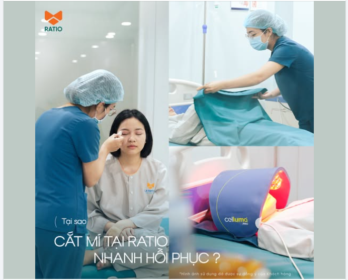 Vì sao cắt mí tại Ratio hồi phục nhanh hơn?  Không phải vì làm “nhẹ tay hơn”. Mà vì không dừng lại ở ca mổ.