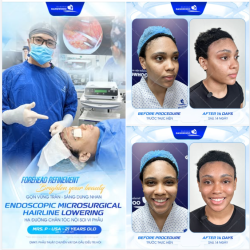 Người khác thì bận thử đủ kiểu tóc, mình thì cứ tóc mái phủ kín cả trán không thay đổi