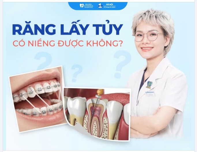 RĂNG ĐÃ LẤY TỦY RỒI, CÓ NIỀNG ĐƯỢC KHÔNG?