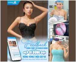 FEEDBACK CHÂN THẬT TỪ KHÁCH HÀNG – ĐẸP ĐI ĐỪNG ĐỢI