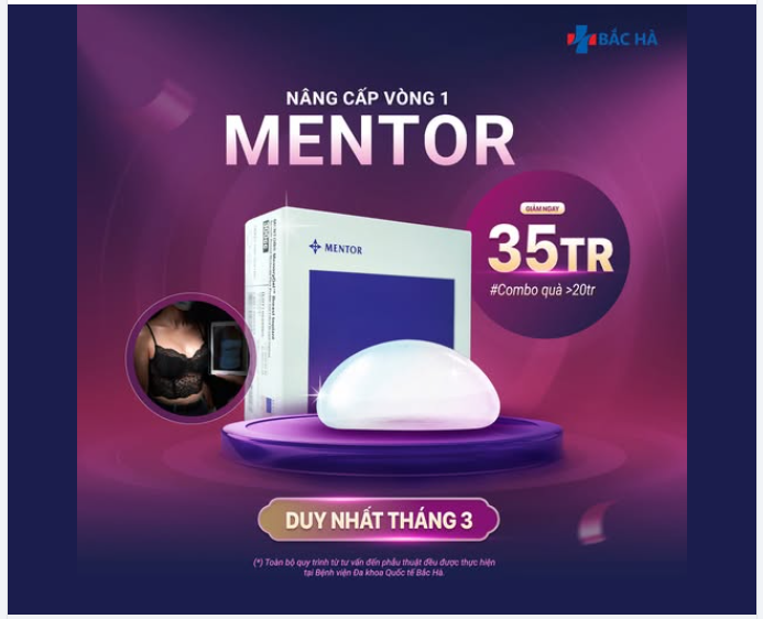 MENTOR – DÒNG TÚI NÂNG NGỰC “QUỐC DÂN” ĐƯỢC NHIỀU CHỊ EM LỰA CHỌN…