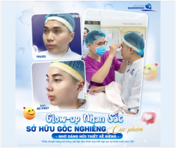 Góc nghiêng hoàn hảo không tự nhiên sinh ra, mà là do anh em chưa chọn đúng nơi để nâng tầm diện mạo! INBOX ngay.