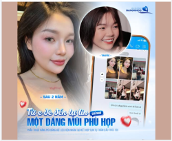 ​​​​​​​ Nhiều người hỏi: "Nâng mũi xong vài năm có xuống cấp không?". Câu trả lời nằm ngay ở tấm hình này của khách nhà Gangwhoo sau 2 năm đây ạ!