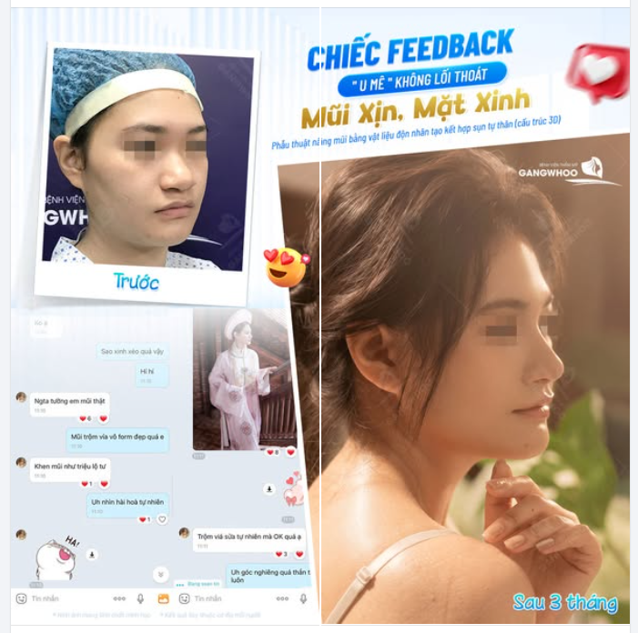 CHIẾC FEEDBACK "U MÊ" KHÔNG LỐI THOÁT